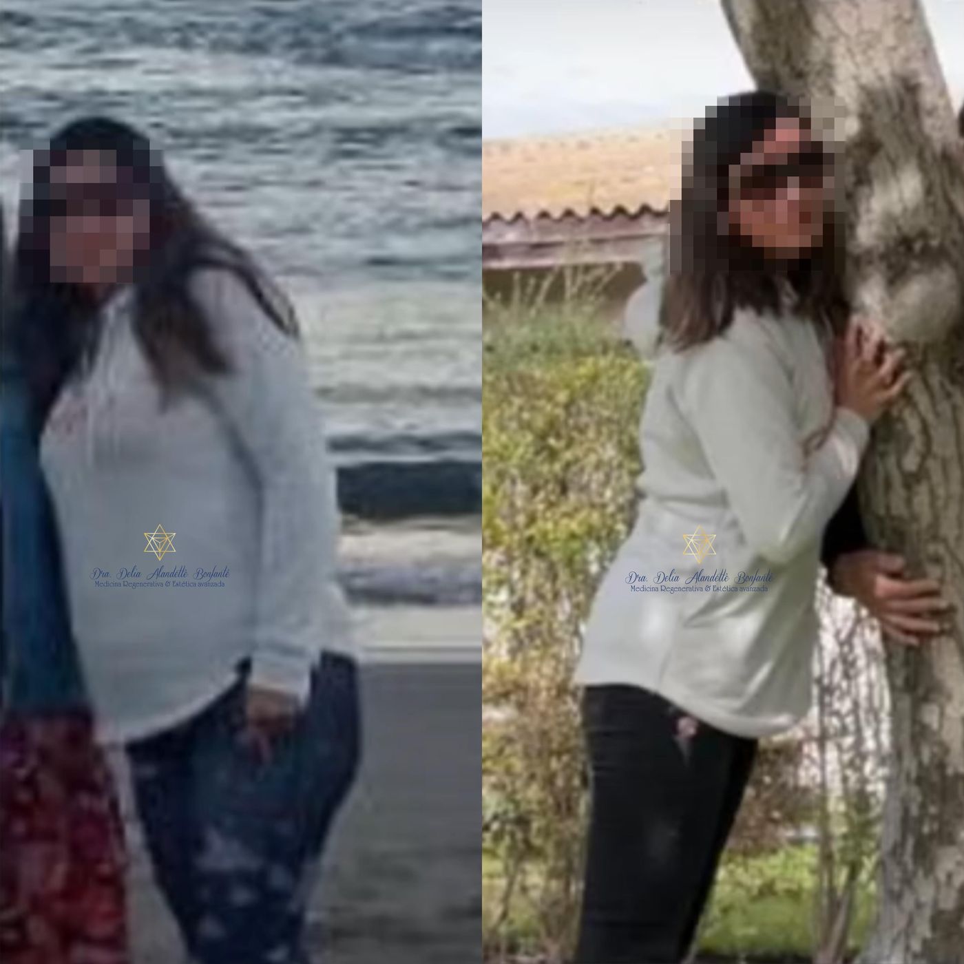 Antes y después de una paciente del programa METABOLIC Control