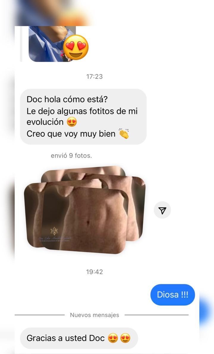 Mensaje de una paciente compartiendo la evolución de su abdomen