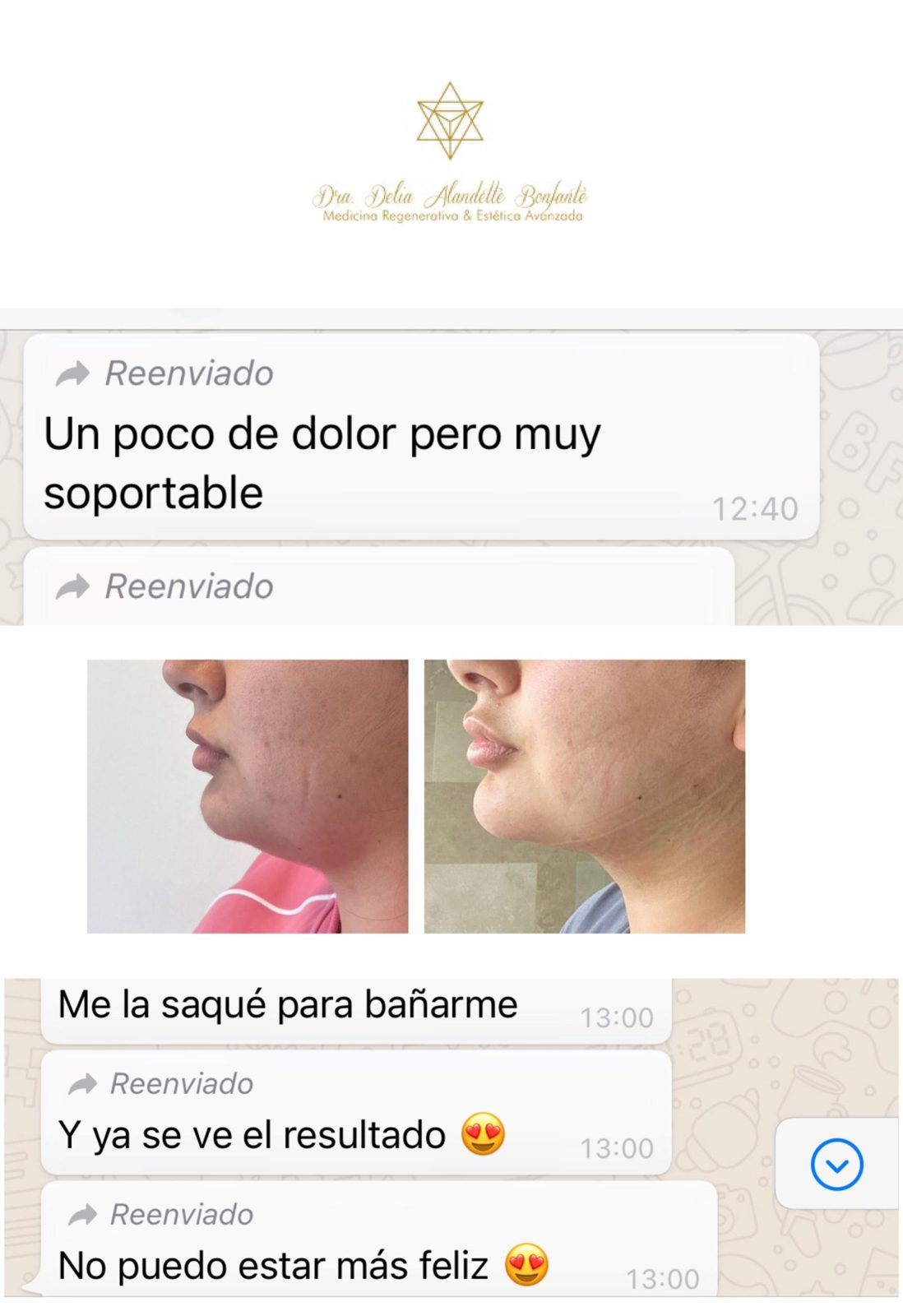 Mensaje de una paciente después de su lipopapada